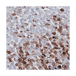 C1orf68, Rabbit, Polyclonal Antibody, Abnova 100&mu;L; Unlabeled:Antibodies,