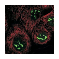 DNTTIP2, Rabbit, Polyclonal Antibody, Abnova 100&mu;L; Unlabeled:Antibodies,
