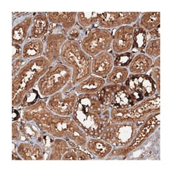 CCDC81 Rabbit anti-Human, Polyclonal Antibody, Abnova 100 &mu;L | Buy Online | Abnova Corporation | Fisher Scientific