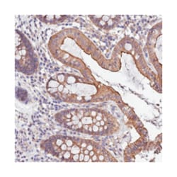 QRFP, Rabbit, Polyclonal Antibody, Abnova 100&mu;L; Unlabeled:Antibodies,