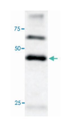 ATG4B, Rabbit, Polyclonal Antibody, Abnova 100 &mu;L | Buy Online | Abnova | Fisher Scientific