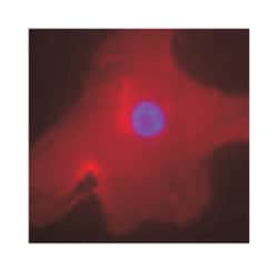 MLXIPL Rabbit anti-Human, Mouse, Rat, Polyclonal Antibody, Abnova 100 &mu;L | Buy Online | Abnova Corporation | Fisher Scientific