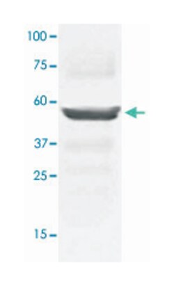 MAP2K5 Rabbit anti-Chicken, Dog, Human, Mouse, Rat, Polyclonal Antibody, Abnova 100 &mu;g | Buy Online | Abnova | Fisher Scientific