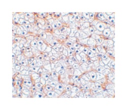 TNFRSF12A Rabbit anti-Human, Polyclonal Antibody, Abnova 100&mu;g; Unlabeled:Antibodies,
