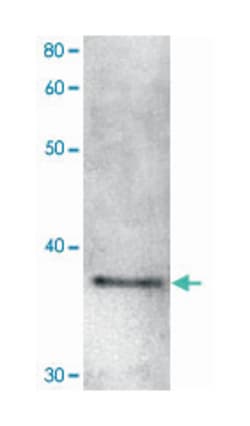 Sgo1, Rabbit, Polyclonal Antibody, Abnova 100&mu;L; Unlabeled:Antibodies,