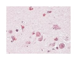 CHN2, Goat, Polyclonal Antibody, Abnova 100 &mu;g | Buy Online | Abnova | Fisher Scientific