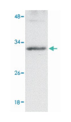GNPDA2, Rabbit, Polyclonal Antibody, Abnova 100 &mu;g | Buy Online | Abnova | Fisher Scientific