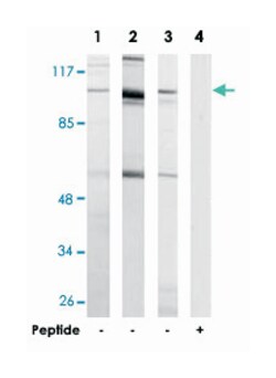 ERAP1 Rabbit anti-Human, Mouse, Rat, Polyclonal Antibody, Abnova 100 &mu;g | Buy Online | Abnova Corporation | Fisher Scientific