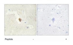 ADCY7, Rabbit, Polyclonal Antibody, Abnova 100 &mu;g | Buy Online | Abnova Corporation | Fisher Scientific