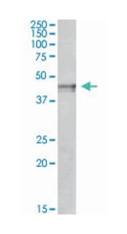 OPRK1, Goat, Polyclonal Antibody, Abnova 100&mu;g; Unlabeled:Antibodies,