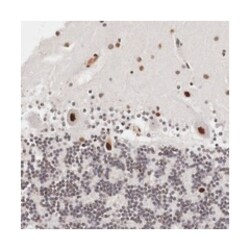 DACH2, Rabbit, Polyclonal Antibody, Abnova 100&mu;L; Unlabeled:Antibodies,