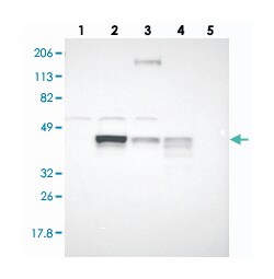 SLC9A3R2, Rabbit, Polyclonal Antibody, Abnova 100&mu;L; Unlabeled:Antibodies,