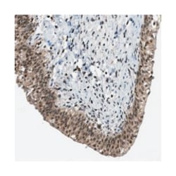 ATF7IP Rabbit anti-Human, Polyclonal Antibody, Abnova 100 &mu;L | Buy Online | Abnova Corporation | Fisher Scientific