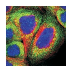 TRIOBP Rabbit anti-Human, Polyclonal Antibody, Abnova 100&mu;L; Unlabeled:Antibodies,