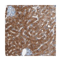 RGP1 Rabbit anti-Human, Polyclonal Antibody, Abnova 100&mu;L; Unlabeled:Antibodies,