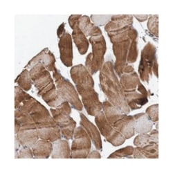 WBSCR27, Rabbit, Polyclonal Antibody, Abnova 100 &mu;L | Buy Online | Abnova Corporation | Fisher Scientific