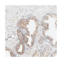 YIPF7, Rabbit, Polyclonal Antibody, Abnova 100 &mu;L | Buy Online | Abnova Corporation | Fisher Scientific