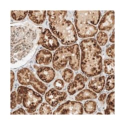 CPAMD8, Rabbit, Polyclonal Antibody, Abnova 100 &mu;L | Buy Online | Abnova Corporation | Fisher Scientific