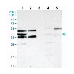FEZ2 Rabbit anti-Human, Polyclonal Antibody, Abnova 100 &mu;L | Buy Online | Abnova Corporation | Fisher Scientific