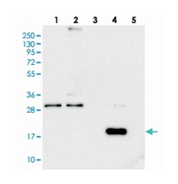 RWDD4A, Rabbit, Polyclonal Antibody, Abnova 100 &mu;L | Buy Online | Abnova Corporation | Fisher Scientific