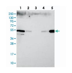 ZFYVE27, Rabbit, Polyclonal Antibody, Abnova 100 &mu;L | Buy Online | Abnova Corporation | Fisher Scientific