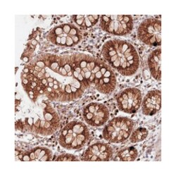 COPG, Rabbit, Polyclonal Antibody, Abnova 100&mu;L; Unlabeled:Antibodies,