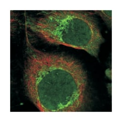 CHCHD1, Rabbit, Polyclonal Antibody, Abnova 100 &mu;L | Buy Online | Abnova Corporation | Fisher Scientific