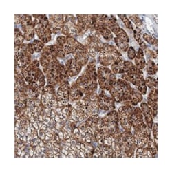 PANX2, Rabbit, Polyclonal Antibody, Abnova 100&mu;L; Unlabeled:Antibodies,