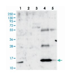 PLAC8, Rabbit, Polyclonal Antibody, Abnova 100&mu;L; Unlabeled:Antibodies,