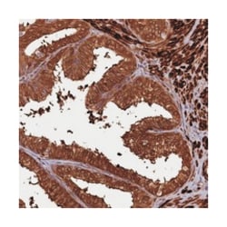 CCDC102A Rabbit anti-Human, Polyclonal Antibody, Abnova 100&mu;L; Unlabeled:Antibodies,