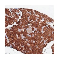 TRAPPC6A, Rabbit, Polyclonal Antibody, Abnova 100 &mu;L | Buy Online | Abnova Corporation | Fisher Scientific