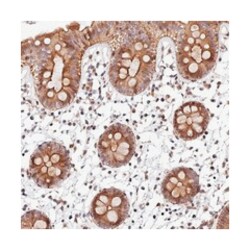 C19orf42, Rabbit, Polyclonal Antibody, Abnova 100 &mu;L | Buy Online | Abnova Corporation | Fisher Scientific