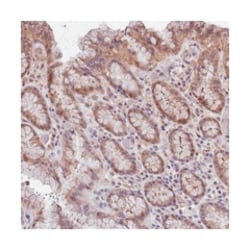 C9orf167, Rabbit, Polyclonal Antibody, Abnova 100 &mu;L | Buy Online | Abnova Corporation | Fisher Scientific