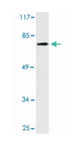 COX2, Rabbit, Polyclonal Antibody, Abnova 100&mu;L; Unlabeled:Antibodies,