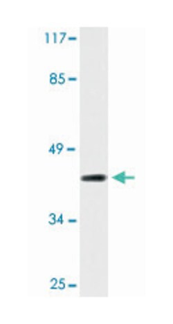 TBX1 Rabbit anti-Human, Polyclonal Antibody, Abnova 100 &mu;L | Buy Online | Abnova | Fisher Scientific