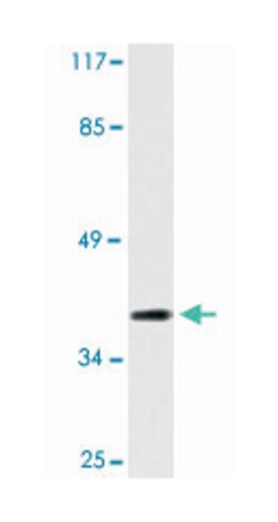 CLN6 Rabbit anti-Human, Polyclonal Antibody, Abnova 100&mu;L; Unlabeled:Antibodies,