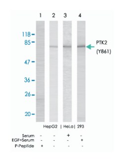 PTK2 (phospho Y861), Rabbit anti-Human, Mouse, Rat, Polyclonal Antibody,