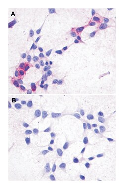 GPR44 Rabbit anti-Human, Monkey, Polyclonal Antibody, Abnova 50 &mu;g | Buy Online | Abnova | Fisher Scientific
