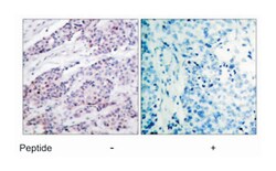 BCL2 Rabbit anti-Human, Polyclonal Antibody, Abnova 100 &mu;g | Buy Online | Abnova Corporation | Fisher Scientific