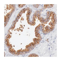 GAL3ST1, Rabbit, Polyclonal Antibody, Abnova 100&mu;L; Unlabeled:Antibodies,