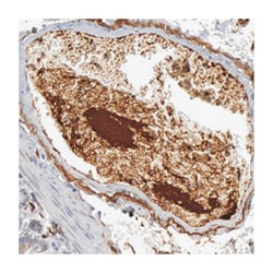 C1QC, Rabbit, Polyclonal Antibody, Abnova 100 &mu;L | Buy Online | Abnova | Fisher Scientific