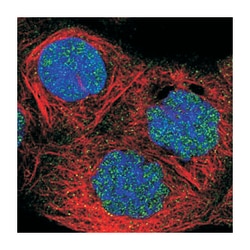 FBXO11, Rabbit, Polyclonal Antibody, Abnova 100&mu;L; Unlabeled:Antibodies,