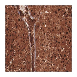 FTSJ1, Rabbit, Polyclonal Antibody, Abnova 100 &mu;L | Buy Online | Abnova Corporation | Fisher Scientific