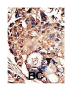 PACSIN1 Rabbit anti-Human, Mouse, Polyclonal Antibody, Abnova 400&mu;L;