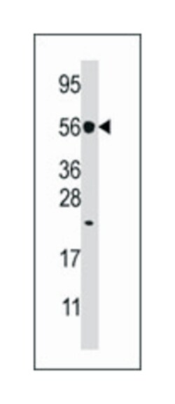 DUSP8 Rabbit anti-Human, Polyclonal Antibody, Abnova 400&mu;L; Unlabeled:Antibodies,