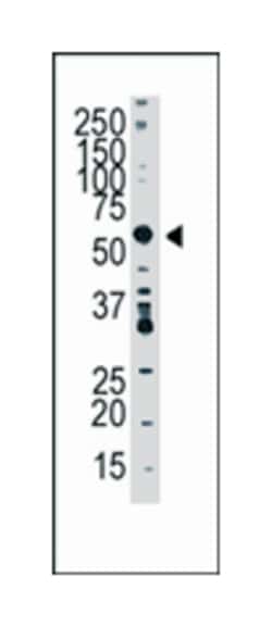 SPTLC1 Rabbit anti-Human, Mouse, Polyclonal Antibody, Abnova 400 &mu;L | Buy Online | Abnova Corporation | Fisher Scientific