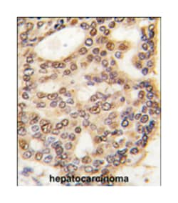 HDGF, Rabbit, Polyclonal Antibody, Abnova 400 &mu;L | Buy Online | Abnova | Fisher Scientific