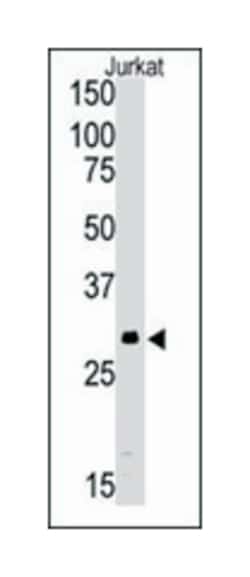 SIRT5 Rabbit anti-Human, Polyclonal Antibody, Abnova 400&mu;L; Unlabeled:Antibodies,