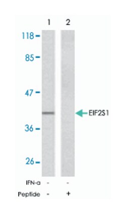 EIF2S1 Rabbit anti-Human, Mouse, Rat, Polyclonal Antibody, Abnova 100 &mu;g | Buy Online | Abnova Corporation | Fisher Scientific