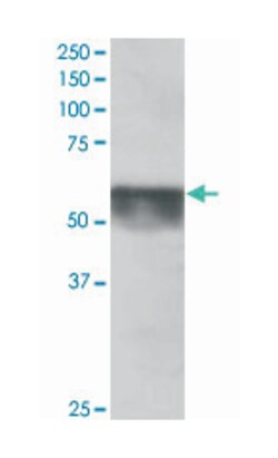 KPNA4, Goat, Polyclonal Antibody, Abnova 100 &mu;g | Buy Online | Abnova Corporation | Fisher Scientific